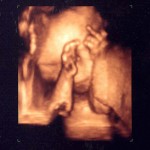 Flipping-off-the-Ultrasound